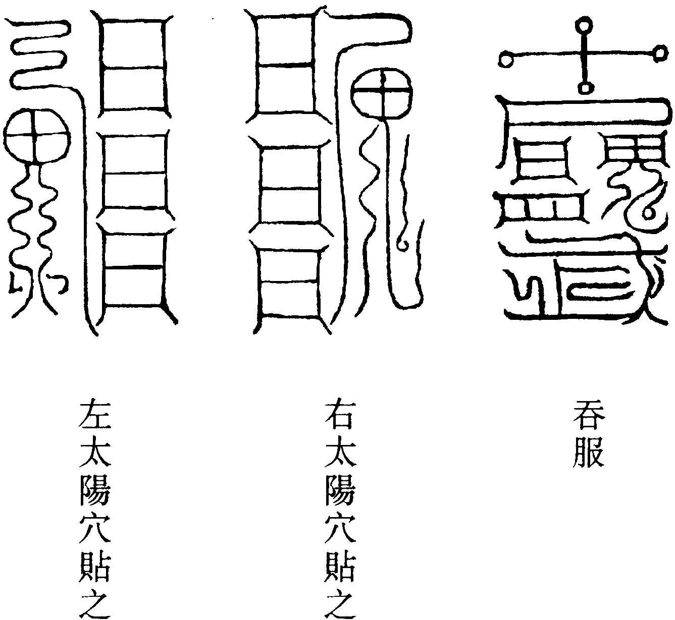 天蓬治頭痛符